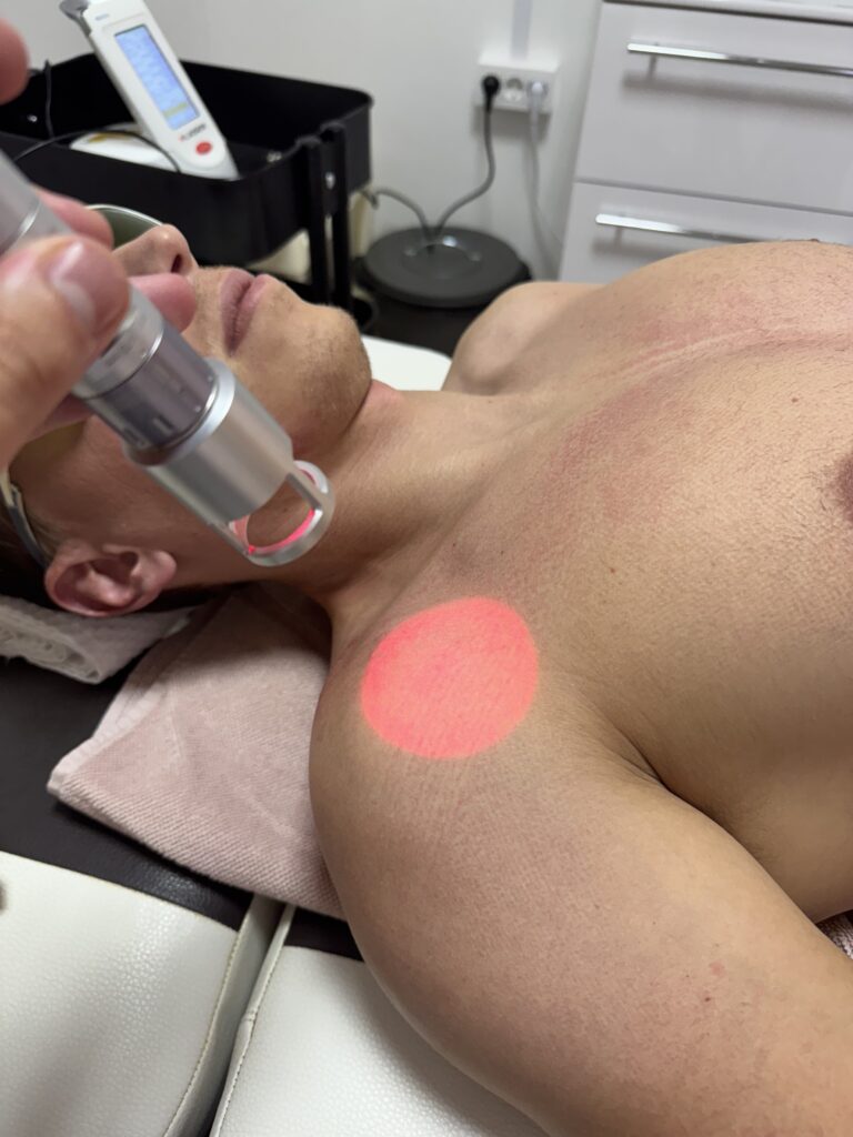 Fizioterapevt izvaja elektroterapijo na pacientu v Novi Gorici za rehabilitacijo po poškodbi.